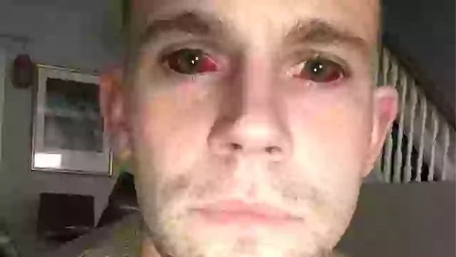 Man was left in coma with ‘devil eyes’ after five-day cocaine-fuelled session almost killed him